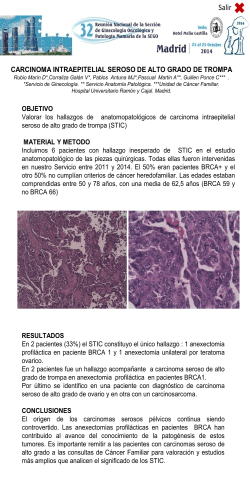 Carcinoma intraepitelial seroso de trompa. (ID 442)