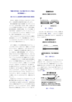 1 「褥瘡の局所治療－TIME 理論で考えるラップ療法と 陰圧閉鎖  - Ne