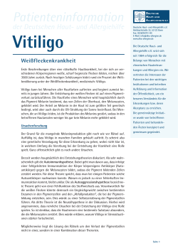 Vitiligo - Deutsche Haut
