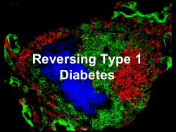 Reversing Diabetes - JDRF TypeOneNation DC Research Summit