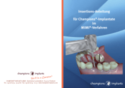 Insertions-Anleitung für Champions®-Implantate im MIMI®