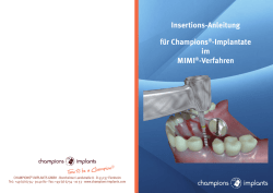 Insertions-Anleitung f&uuml;r Champions&reg;-Implantate im MIMI&reg;