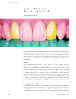 VITA SUPRINITY: Der perfekte Fall - Digital Dental Magazin