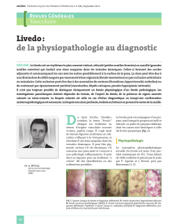 Livedo : de la physiopathologie au diagnostic