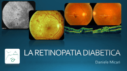 La retinopatia diabetica