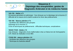 S&eacute;quence 4 CC 14h