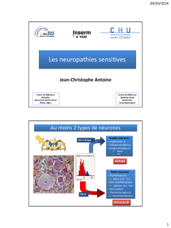 Les neuropathies sensitives