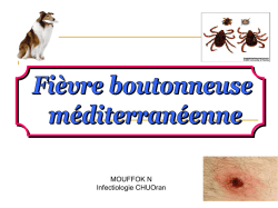 fievre boutonneuse mediterraneenne - Portail