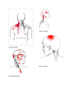 William Teachey MD His Experience with Trigger