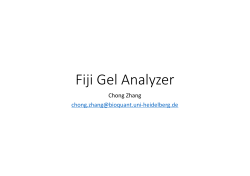 Fiji Gel Analyzer