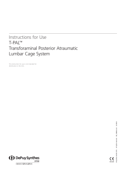 Instructions for Use T-PAL™ Transforaminal Posterior