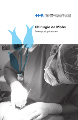 Chirurgie de Mohs : soins postopératoires
