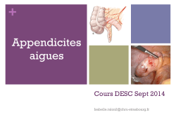 Appendicite Aiguë - Lacreuse - 17-09-2014