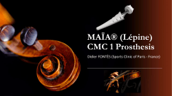 MAÏA® (Lépine) CMC 1 Prosthesis