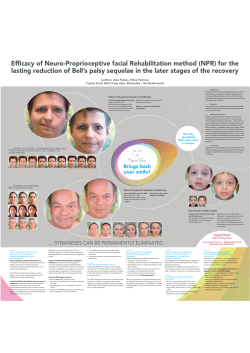 Efficacy of Neuro-Proprioceptive facial Rehabilitation method (NPR