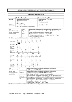 item 284 &ndash; trouble de la conduction intracardiaque