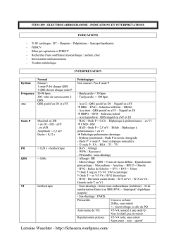 item 309 &ndash; electrocardiogramme indications et