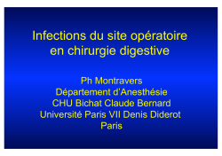 ISO en chirurgie digestive