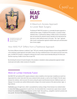 MAS&reg; PLIF - NuVasive&reg;, Inc.