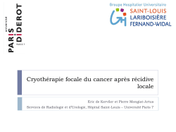 cryotherapie focale du cancer apres recidive locale
