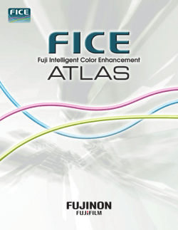 Fuji Intelligent Color Enhancement Spectral Endoscopic Image