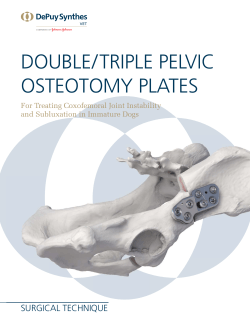 double/triple pelvic osteotomy plates technique guide