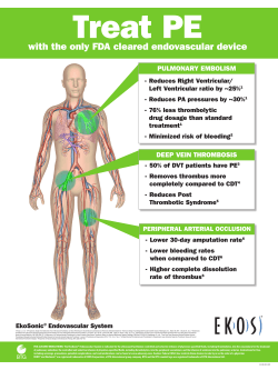 Pulmonary Embolism Interventional Radiology Treatment