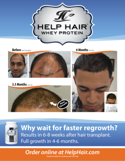Why wait for faster regrowth?
