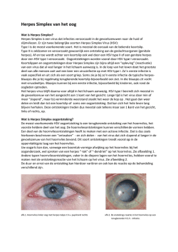 Herpes Simplex van het oog - Nederlands Oogheelkundig Gezelschap