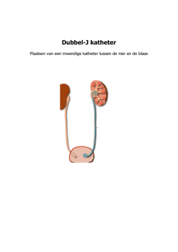 Dubbel-J katheter - TweeSteden ziekenhuis