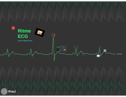 ECG leer - ICverpleegkundige.com