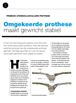 Eerste sternoclaviculaire prothese in het UZ Gent