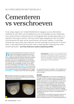 Cementeren vs verschroeven - Centrum voor Implantologie Rotterdam