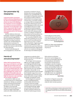 Hernia of zenuwcompressie? Een pacemaker bij