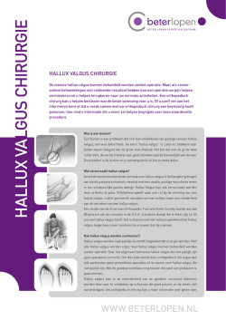 Hallux valgus chirurgie.indd