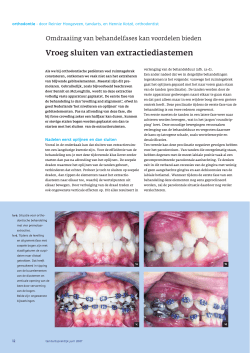 klik hier - Reinier Hoogeveen Orthodontie