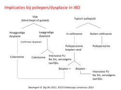 Implicaties bij poliepen/dysplasie in IBD