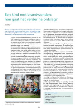 Een kind met brandwonden: hoe gaat het verder na ontslag?