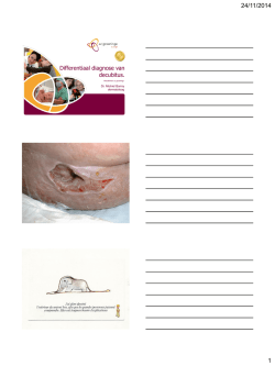 Differentiaal diagnose van decubitus, dr. Michiel