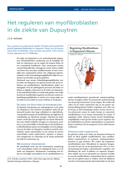 het reguleren van myofibroblasten in de ziekte van dupuytren