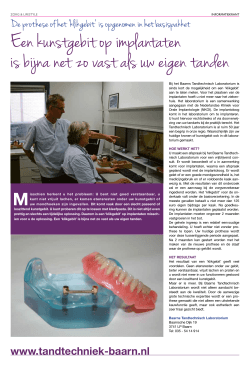 lees meer - Baarns Tandtechnisch Laboratorium