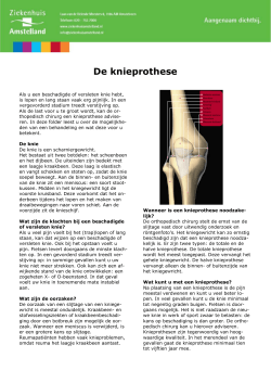 Knieprothese totaal - Ziekenhuis Amstelland
