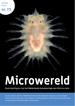 Microwereld - Microscopen Specialist ABRO