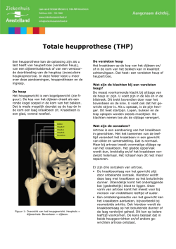 Heupprothese totaal - Ziekenhuis Amstelland