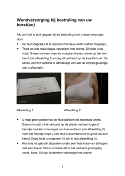 Wondverzorging bij bestraling van uw borst(en)