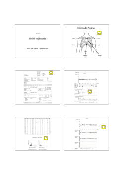 Holter registratie Electrode Posities