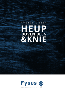Heup – boven been