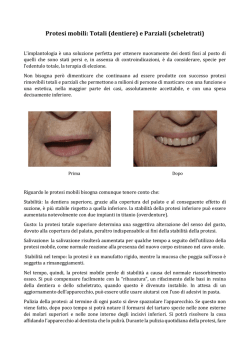 Protesi mobili: Totali (dentiere) e Parziali (scheletrati)
