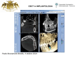 CBCT in Implantologia
