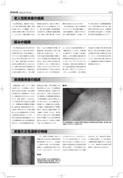 痒みの種類 老人性乾皮症の臨床 皮膚掻痒症の臨床 皮脂欠乏性湿疹の